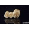 Buy cheap High Biocompatibility Zirconia Full Contour Crown Perfect Fit High Strength from wholesalers