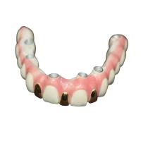 Buy cheap Precision Digital 3D Printing Dental Implant Bar Metal Based product