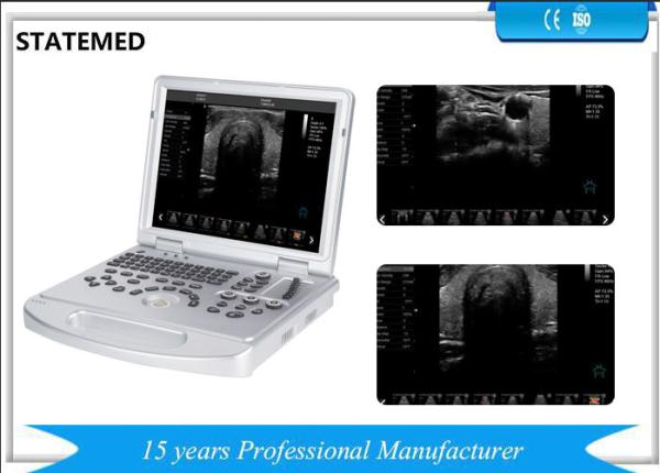 Buy cheap 4D Mobile Ultrasound Scanner Laptop Ultrasound Scanner 0 - 270dB Dynamic Range from wholesalers