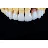 Buy cheap Dental Porcelain Emax Laminate Veneers Seamlessly Customized from wholesalers