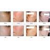 Buy cheap Photobiology PDT LED Light Therapy Machine Skin Rejuvenation High Efficiency from wholesalers