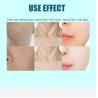 Buy cheap Customized Q Switched Nd Yag Laser Machine Clinical Q Switched Laser Tattoo Removal Machine from wholesalers