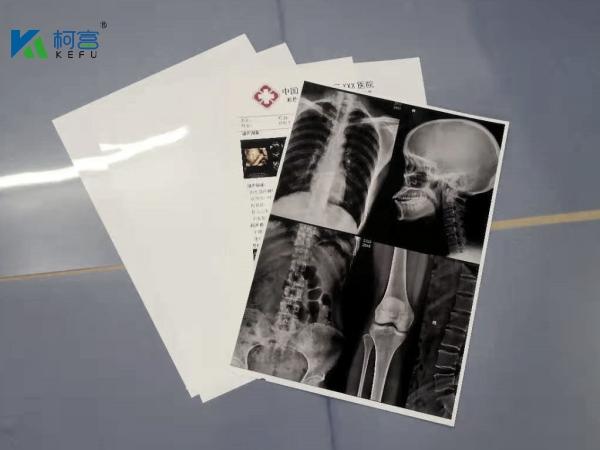 Buy cheap 13X17'' White 180 Microns PET X Ray Film Sheets Transparency Film For Inkjet Printers from wholesalers