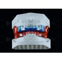 Buy cheap Medical Grade Silicone Anti Snoring Appliance RP For Improved Sleep product