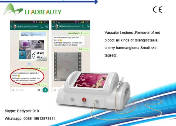 Buy cheap 30MHZ High frequency Portable RBS Spider Vein Removal Machine for Clinic from wholesalers