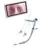 Buy cheap Camera 35fr 37fr 39fr Endobronchial Blocker In Emergency Department from wholesalers