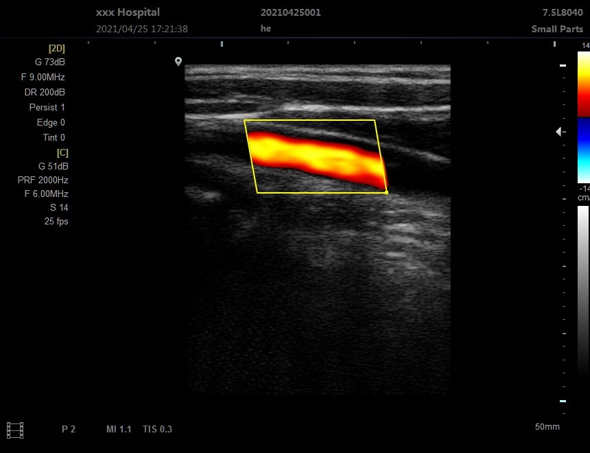OEM Portable 3D Portable Ultrasound Machine For Clinical Hospital