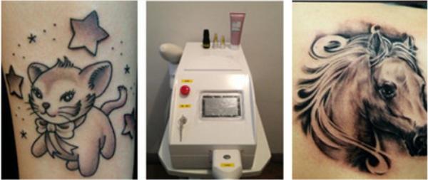 Buy cheap SR ND YAG Laser mini home use Tattoo Removal Machines with Leaving No Scar from wholesalers