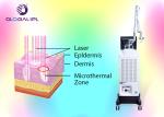 Factory Price Vaginal Tightening Laser Scar Removal Co2 Fractional Laser Machine