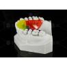 Buy cheap Stainless Steel Acrylic Screw Expander Orthodontic Treatment Removable from wholesalers