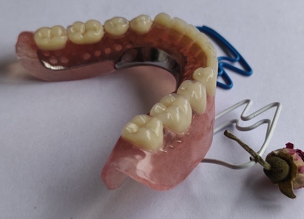 3D Printing Metal Skeleton Partial Denture Metal Framework