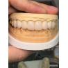 Buy cheap 16 Shades Color Emax Dental Veneers A1-A4 High Stain Resistance For Perfectly Smiles from wholesalers