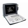 Buy cheap Portable Full Digital Diagnostic Ultrasound scanner OEM from wholesalers