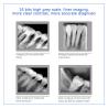 Buy cheap Dental X-Ray Digital Sensor For Dental Implant And Endodontic Treatment from wholesalers