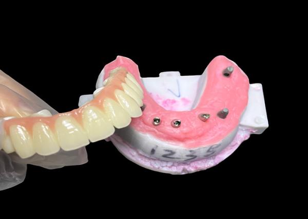 Buy cheap Implant supported Full Arch Denture Fixed Dental implant Ceramic Crown Bridge from wholesalers