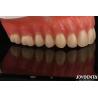 Buy cheap Acrylic Teeth Finish Lightweight Resin Material Dental Restorations Tooth Arrangement from wholesalers