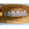 Buy cheap High Permeability Natural Looking Veneers Porcelain Veneers Emax Customized from wholesalers