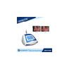 Buy cheap New product ideas 2018 980nm laser cherry angioma blood vessel removal machine from wholesalers