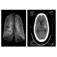 Buy cheap Blue PET Medical X Ray Film 14 x 17in Agfa Drystar 5503 For Hosipital product
