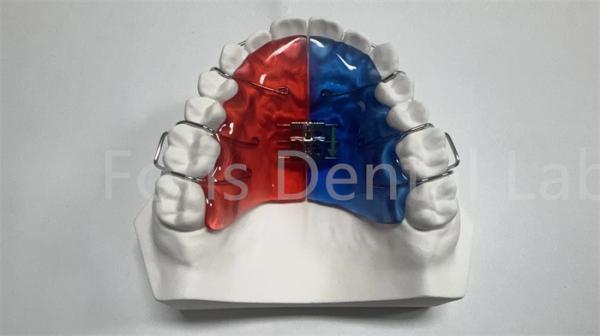 Buy cheap Individual Orthodontic Expander For Dental Correction And Improvement from wholesalers