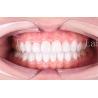 Buy cheap High Translucency Dental Laminate Veneers Long Lasting Durability Polishing Finishing from wholesalers