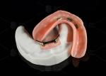 Buy cheap Titanium Alloy Snap On Dolder Implant Bar Overdenture Polished For Natural Smile from wholesalers