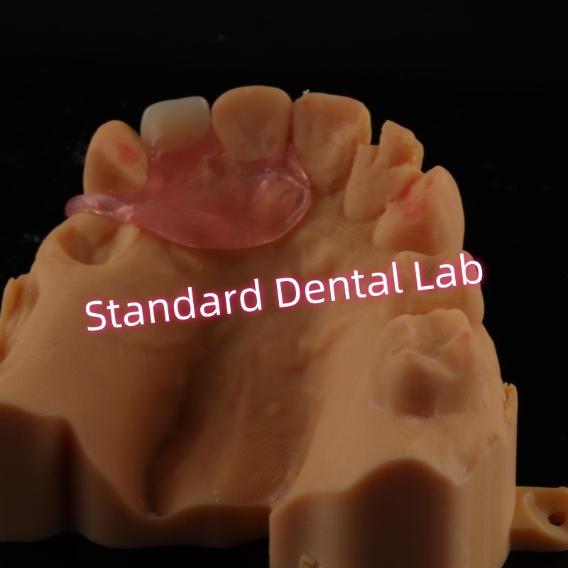 Upper Valplast Unilateral Dentures Removable Flexible One Tooth Partial Teeth