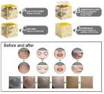 Alexandrite Melasma Picosecond Laser Machine 755nm Tattoo Laser Equipment
