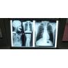 Buy cheap Inkjet X Ray Printer Imager For Printing Film 9600x2400 Dpi from wholesalers