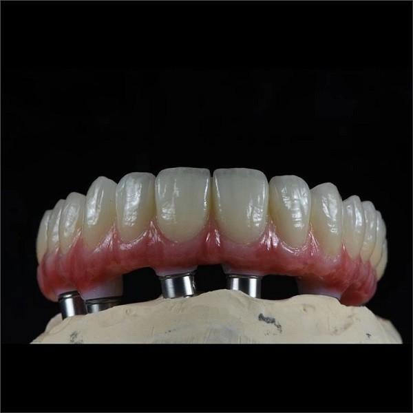 Buy cheap ODM Full Arch Zirconia Implants Bridge Zirconium Implants Holistic Dentistry from wholesalers
