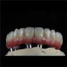 Buy cheap ODM Full Arch Zirconia Implants Bridge Zirconium Implants Holistic Dentistry from wholesalers