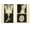 Buy cheap 13in x 17in Degradable X Ray Diagnostic Imaging Medical Paper For Laser Printer from wholesalers