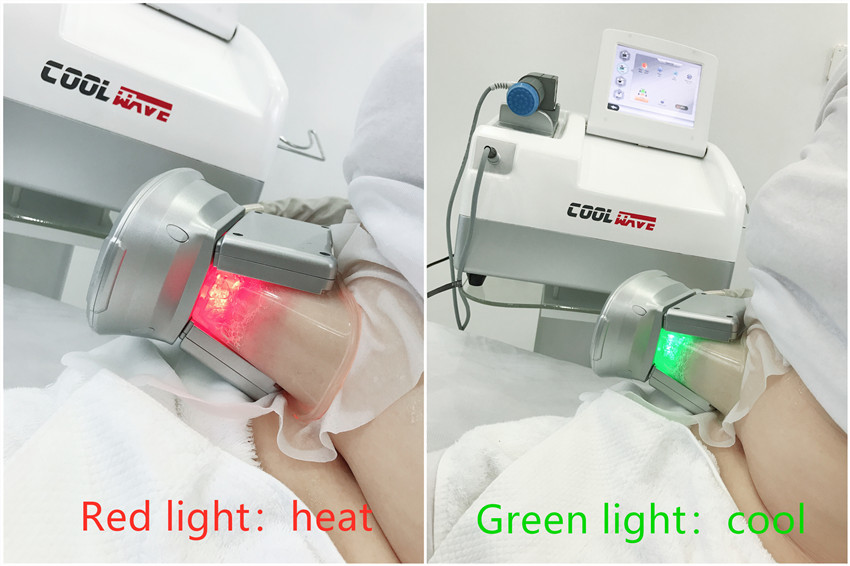 Salon Cryolipolysis Fat Freezing Machine With Shock Wave