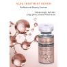Buy cheap OEM ODM Stalidearm Anti Acne Serum Herbal Treatment Skin Repair Care Solution Anti Acne Pimple Scar Remover Face Serum from wholesalers