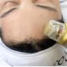 Buy cheap Collagen Remodeling Microneedling Fractional RF Device for facial management from wholesalers