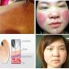 Buy cheap One treatment see effect laser spider vein removal machine mini from wholesalers