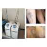 Buy cheap CE Approved ND YAG Laser Tattoo Removal Machine For Laser Pigmentation Removal from wholesalers