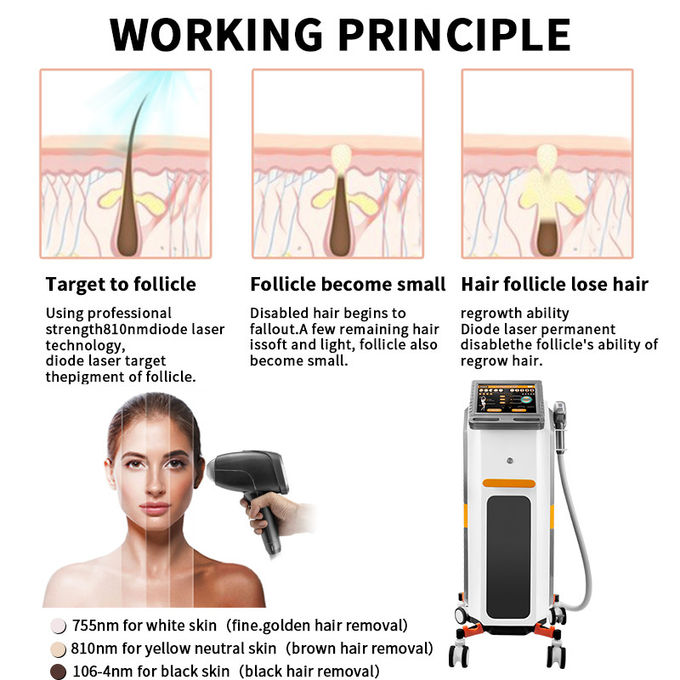 Fast Diode Laser Hair Removal Machine Triple Wave 810nm Skin Rejuvenation 2000w 3