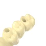 Ultra High Resistance Bridge Resin Temporary Crown Dental 3d Printing Resin