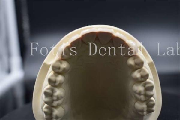 Buy cheap High Strength Artificial Teeth Veneers Dentist Porcelain Veneers Natural Looking from wholesalers