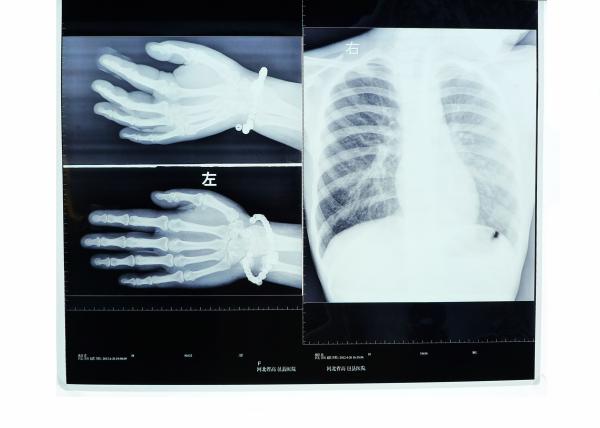Quality Konida Medical Dry Imaging Film Digital X-ray For Fuji / Agfa Printers for sale