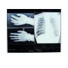 Buy cheap Konida Medical Dry Film High Resolution Heat Resisting Imaging from wholesalers