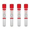 Buy cheap Centrifuge APRF Plastic TUBE 10ml Used For Dental Adhesive Bone from wholesalers