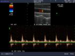 Hitachi Aloka SSD-3500 Linear Array Ultrasound Probe UST-5546