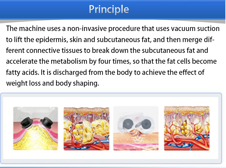 Vacuum Roller Cellulite Reduction Machine , Slimming Body Contouring Machine