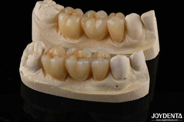 Buy cheap Wear Resistant Zirconia Full Contour Dental Crown High Translucency from wholesalers