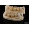 Buy cheap Wear Resistant Zirconia Full Contour Dental Crown High Translucency from wholesalers