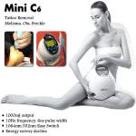 Buy cheap Affordable Q-switched lasers / freckles removal laser machine from wholesalers