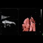 Fetal Doppler Medical Ultrasound Machine Trolley 3D 4D 5D