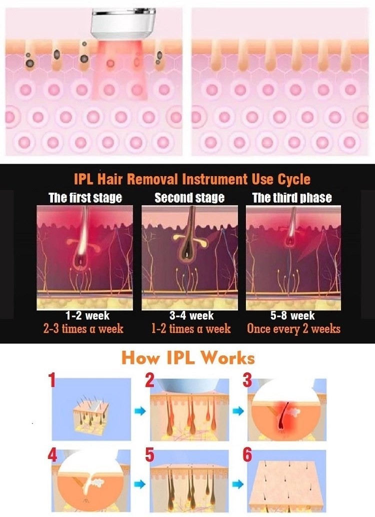5 Levels 240V 4.2cm2 6 Weeks IPL Laser Hair Remover
